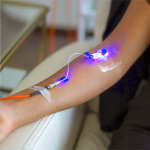 IV Laser Therapy